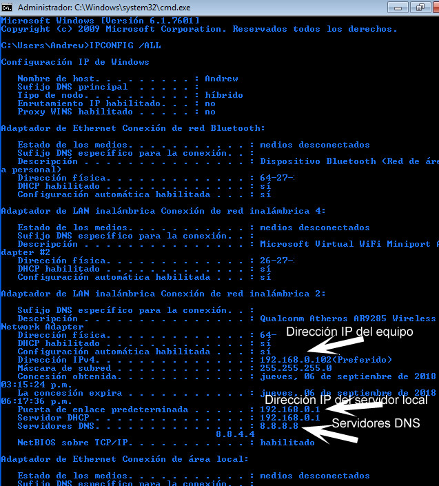 Guía Para El Uso Del Comando IPCONFIG En Windows - Mundonets.Co